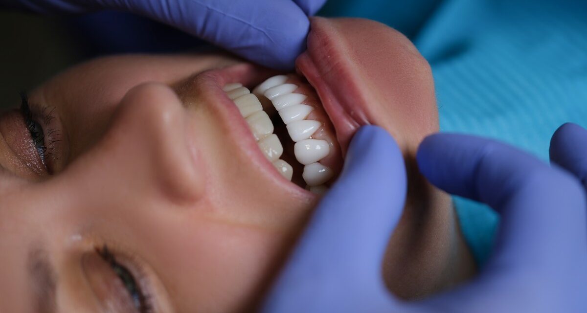 https://trusmiledental.co.uk/wp-content/uploads/Composite-Bonding-vs-Veneers-Comparison-1200x640.jpg