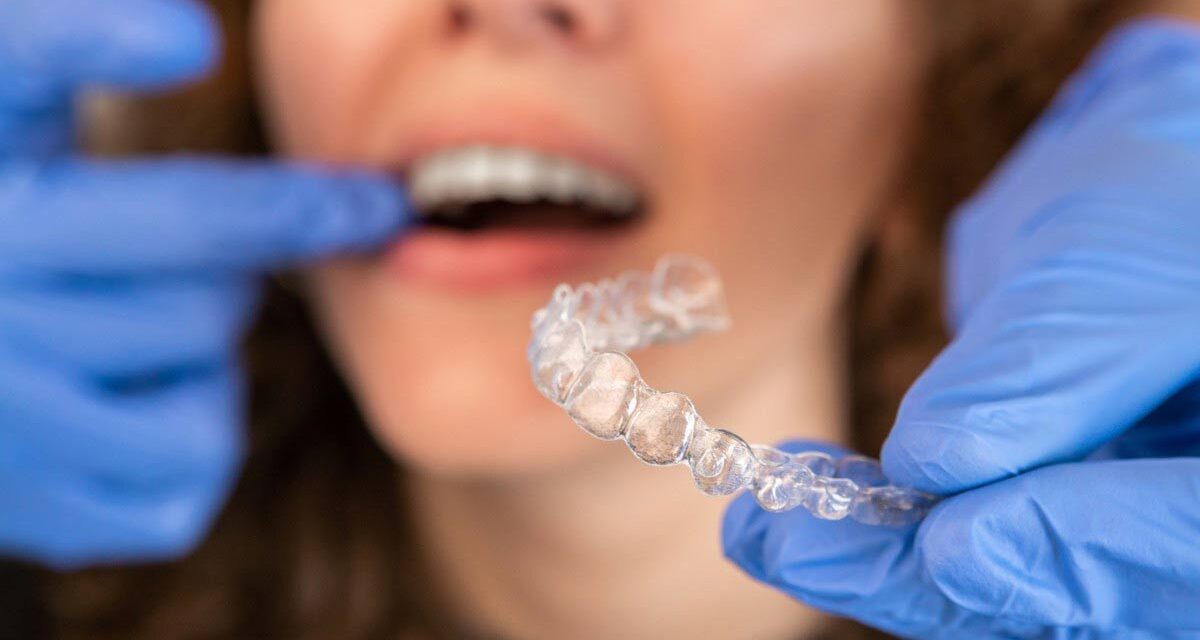https://trusmiledental.co.uk/wp-content/uploads/How-Much-Does-Invisalign-Cost-UK-2024-Prices-1200x640.jpg