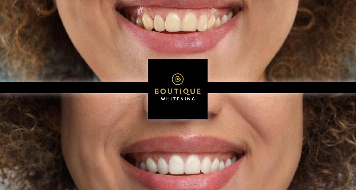 https://trusmiledental.co.uk/wp-content/uploads/boutique-teeth-whitening-1200x640.jpg