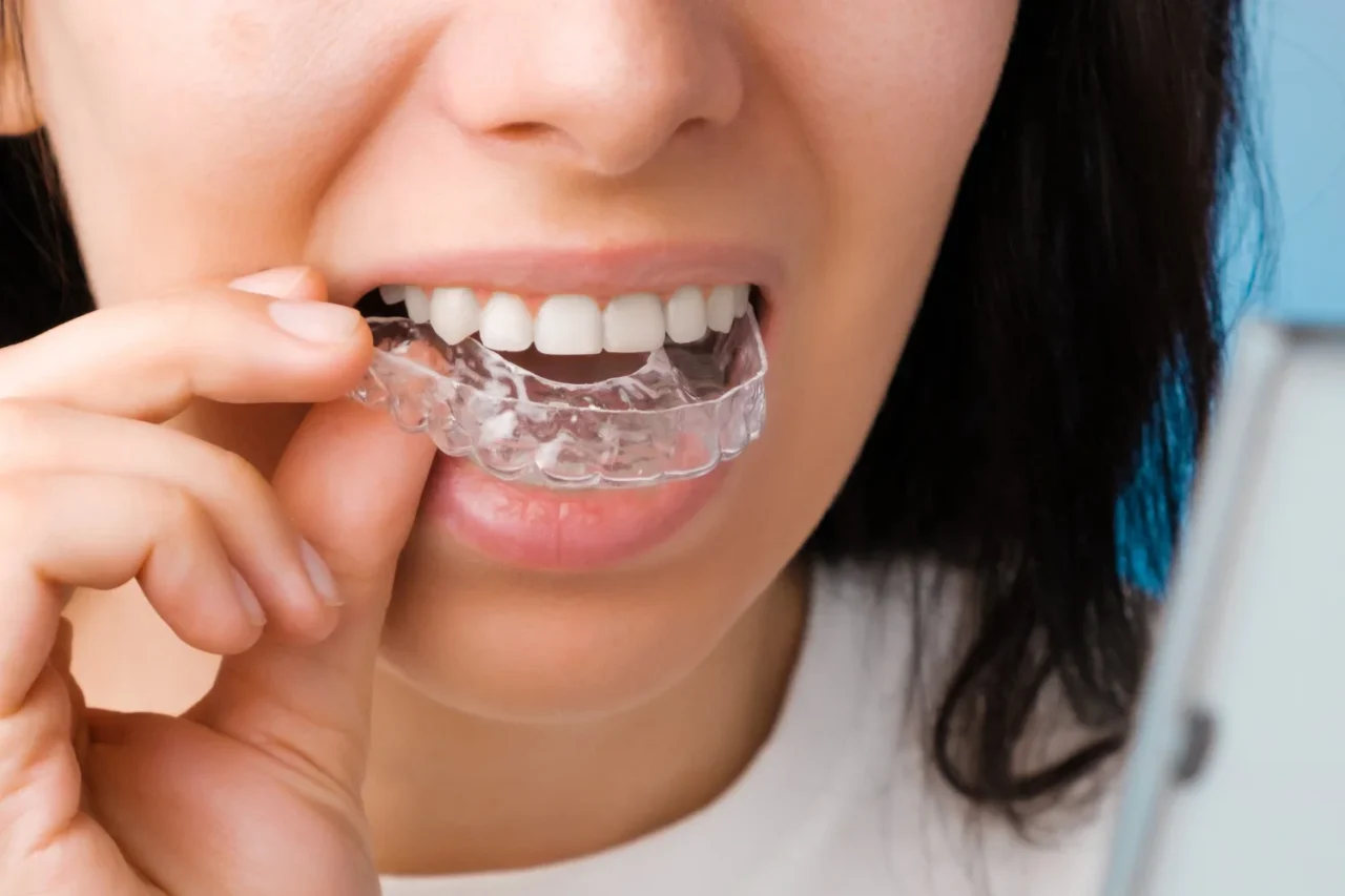 https://trusmiledental.co.uk/wp-content/uploads/can-invisalign-fix-gaps-1280x853.webp