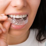 Can Invisalign Fix Gaps