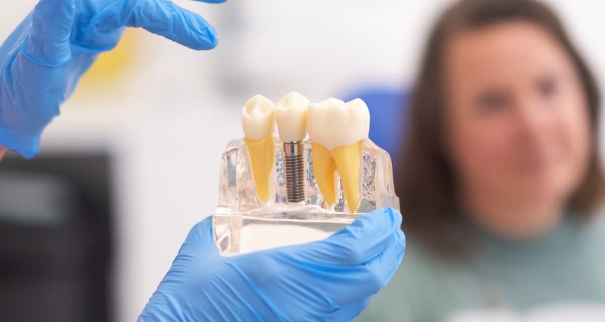 https://trusmiledental.co.uk/wp-content/uploads/dental-implant-costs-uk-1200x640.jpg