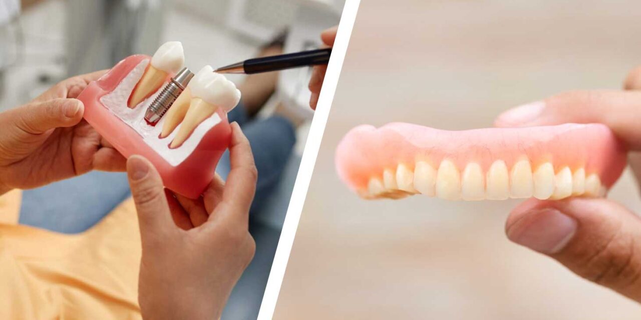https://trusmiledental.co.uk/wp-content/uploads/dentures-vs-implants-guide-costs-1280x640.jpg
