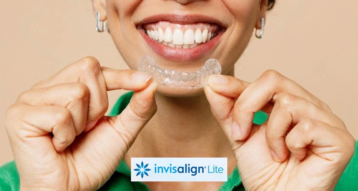 https://trusmiledental.co.uk/wp-content/uploads/invisalign-lite-cost-1200x640.jpg
