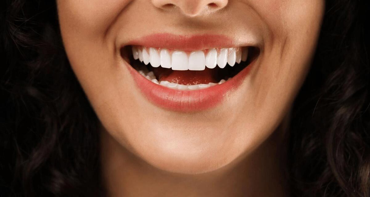 https://trusmiledental.co.uk/wp-content/uploads/veneers-cost-uk-dental-1200x640.jpg