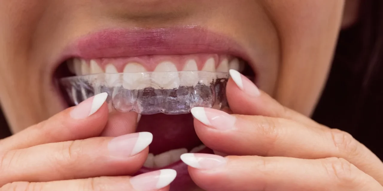 https://trusmiledental.co.uk/wp-content/uploads/vivera-retainers-1280x640.webp